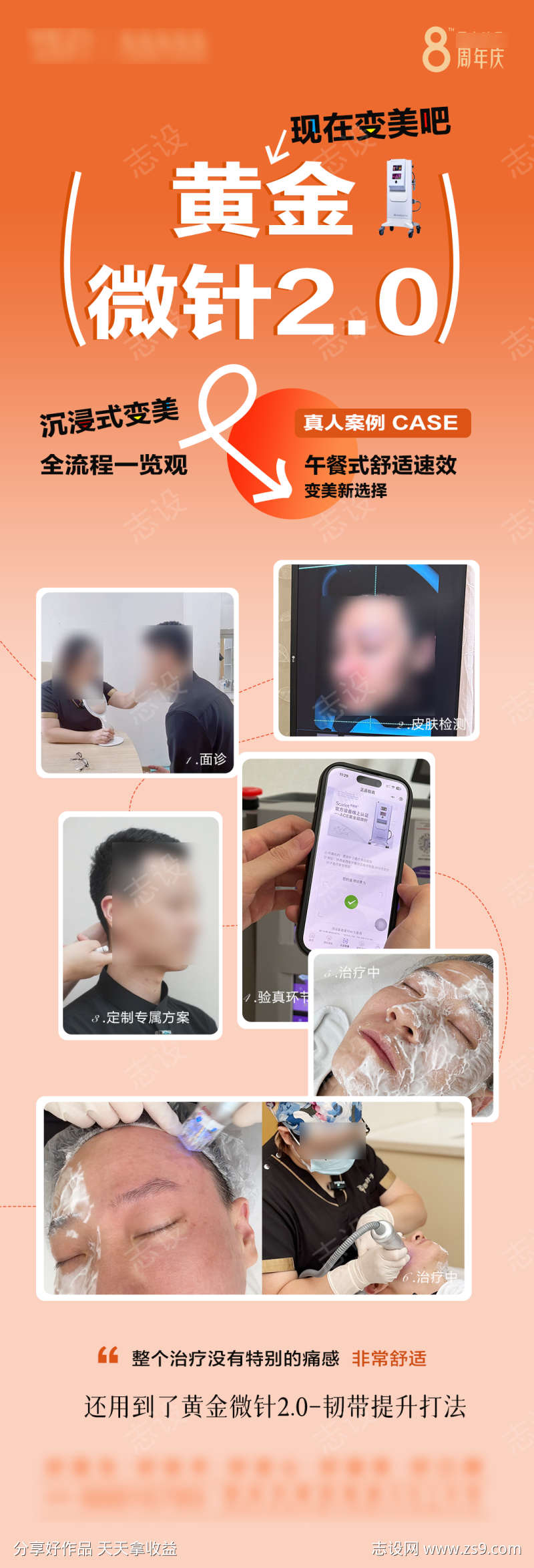 黄金微针案例海报