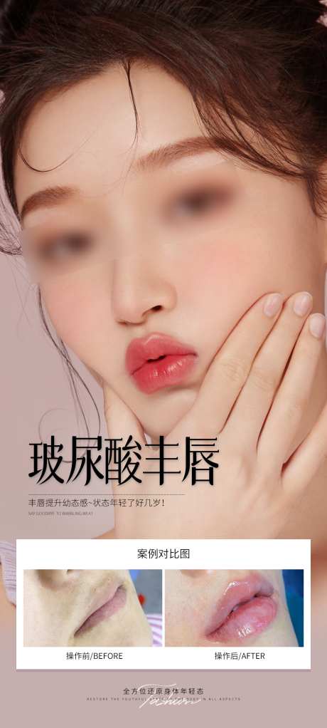 玻尿酸丰唇海报_源文件下载_PSD格式_1080X2400像素-丰唇,玻尿酸,海报-作品编号:2025063013103977-志设-zs9.com