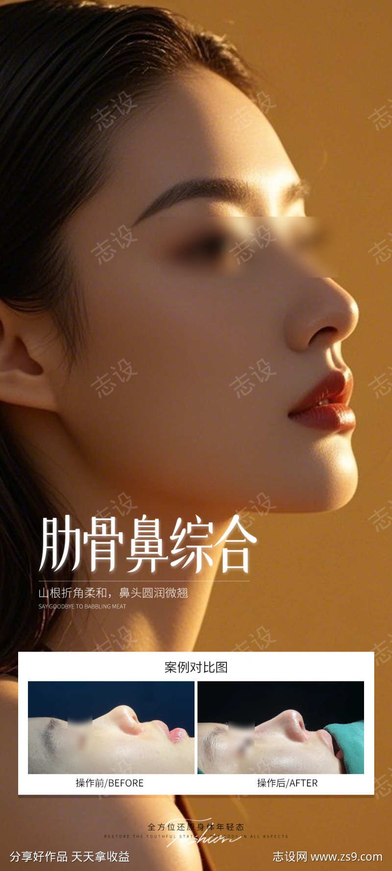 肋骨鼻综合海报