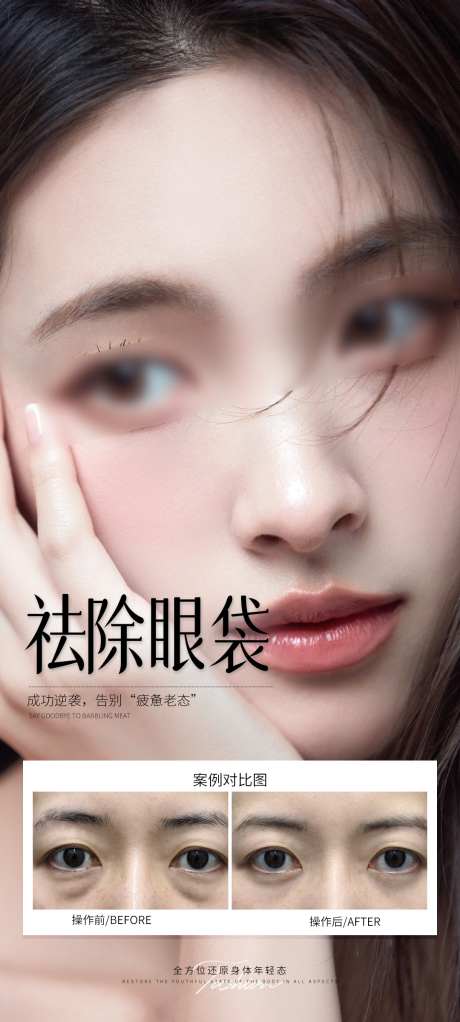 祛除眼袋案例_源文件下载_PSD格式_1080X2400像素-眼袋,海报,案例-作品编号:2025070917117041-志设-zs9.com