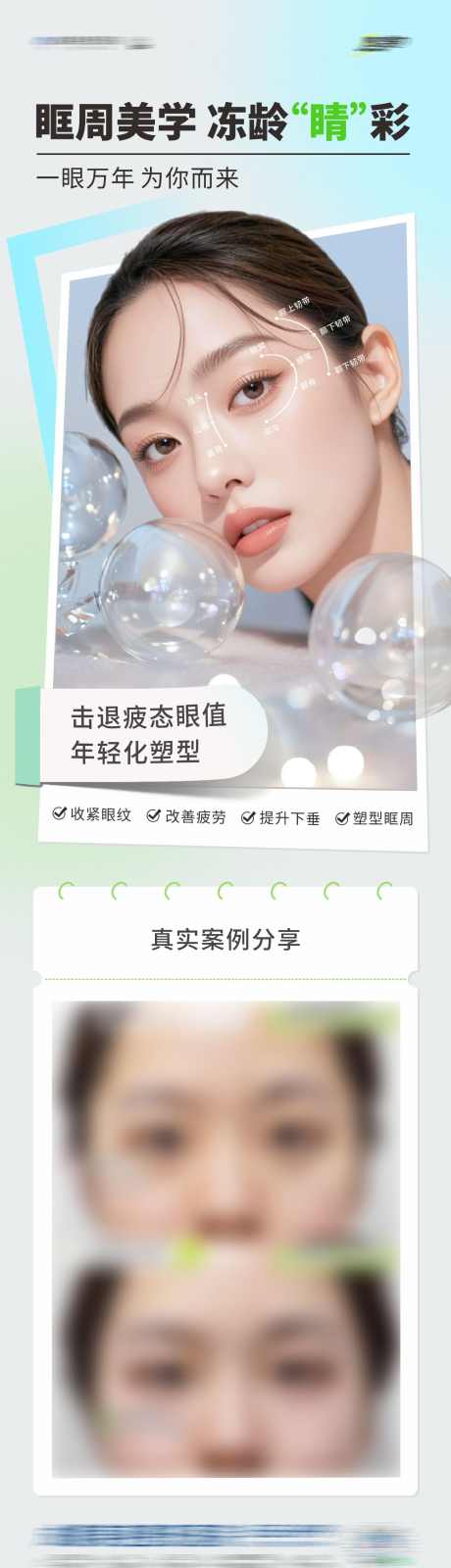医美眼睛眶周美学案例长图海报_源文件下载_CDR格式_1284X4552像素-长图,改善,提升-作品编号:2025071016553010-志˒设˒网