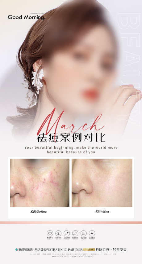 医疗案例对比_源文件下载_PSD格式_1500X2778像素-案例,微调,整形-作品编号:2025071410367930-志设-zs9.com