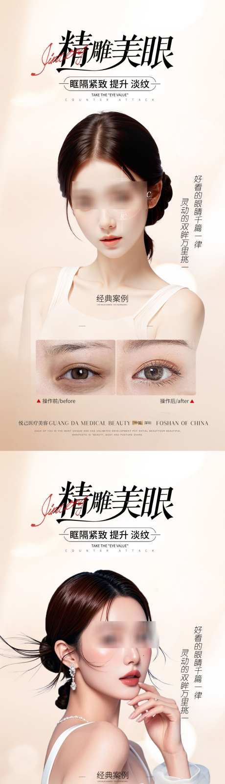 医美双眼皮案例海报_源文件下载_PSD格式_1181X4682像素-双眼皮,对比,案例-作品编号:2025071216207708-志设-zs9.com