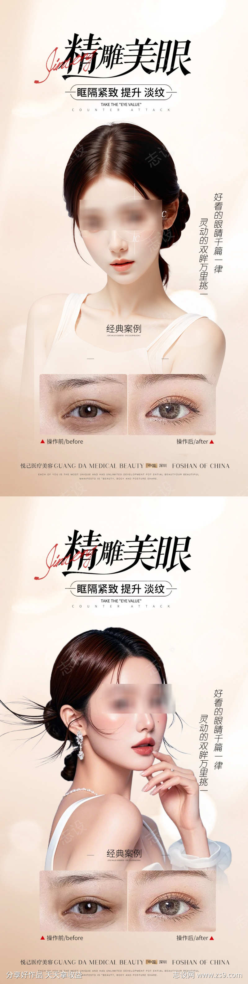 医美双眼皮案例海报