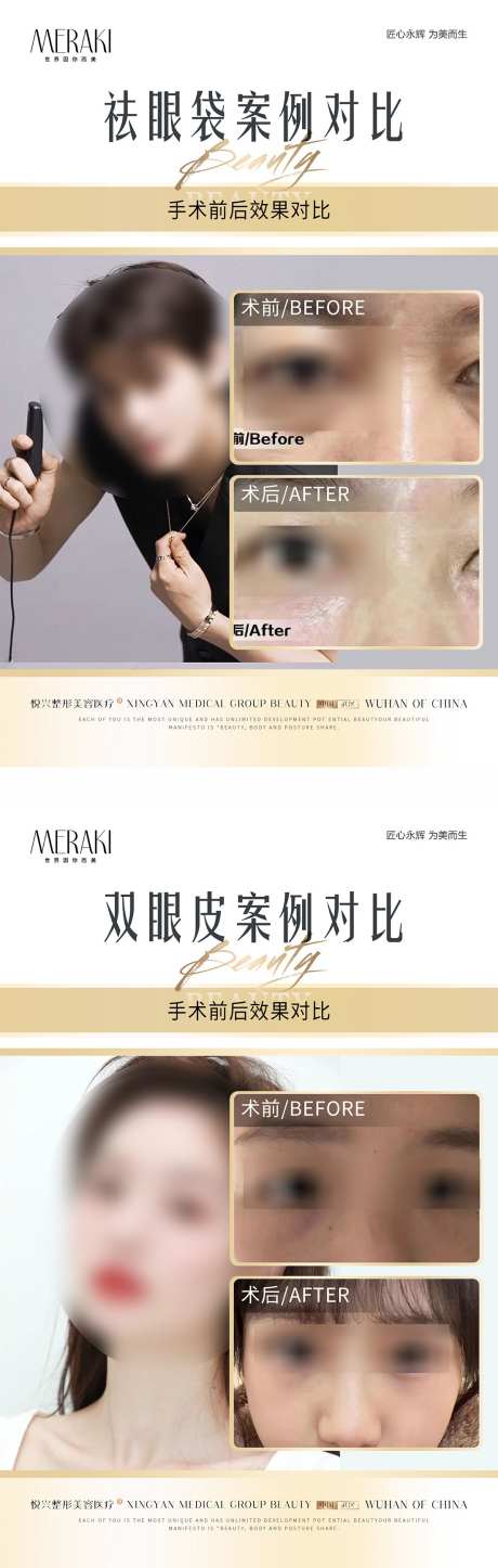 医美案例对比_源文件下载_PSD格式_1103X3467像素-对比,案例,项目-作品编号:2025071310253595-志设