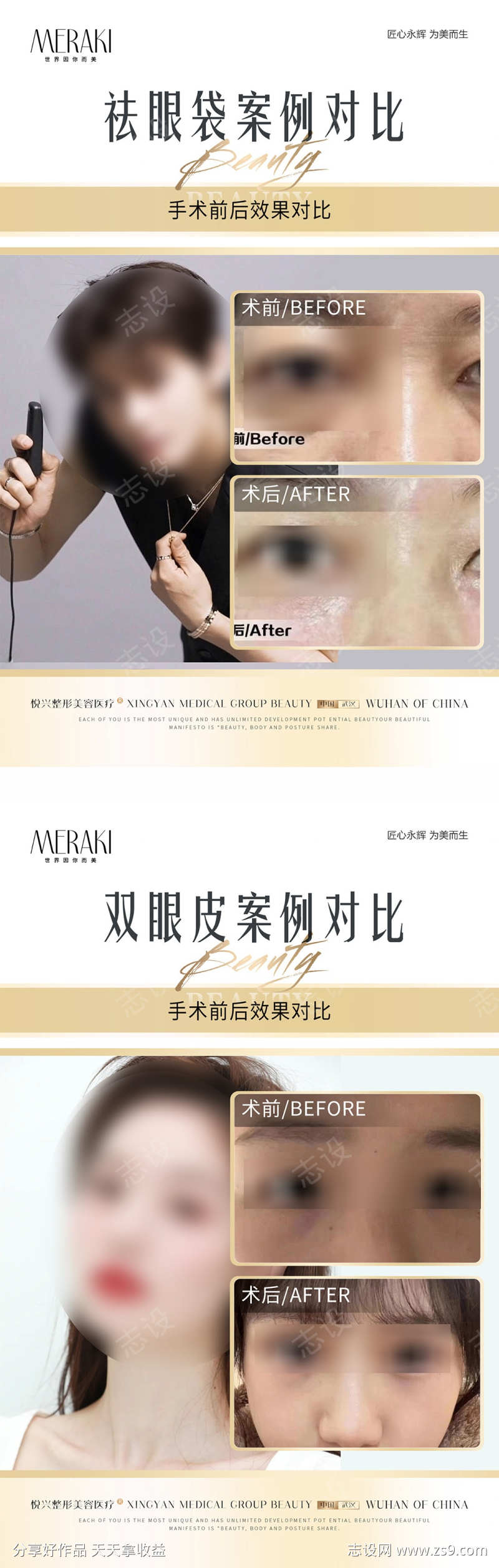 医美案例对比