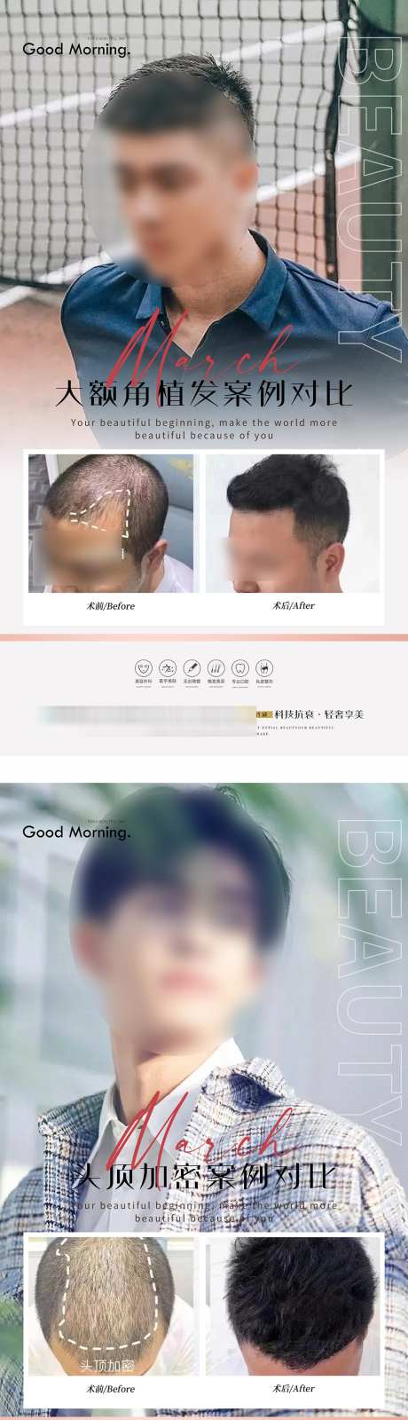 医美案例对比_源文件下载_PSD格式_1102X4155像素-对比,案例,项目-作品编号:2025071310266173-志设-zs9.com