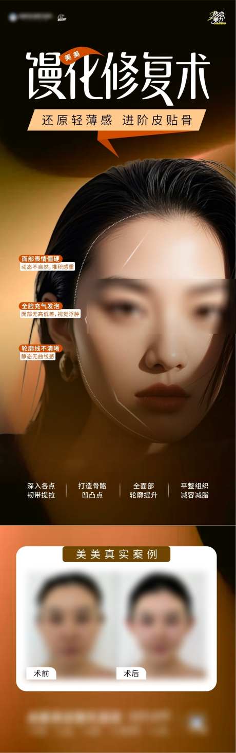 馒化脸修复_源文件下载_CDR格式_1182X3770像素-抗衰,医美,轮廓-作品编号:2025071414175442-志`设˰网