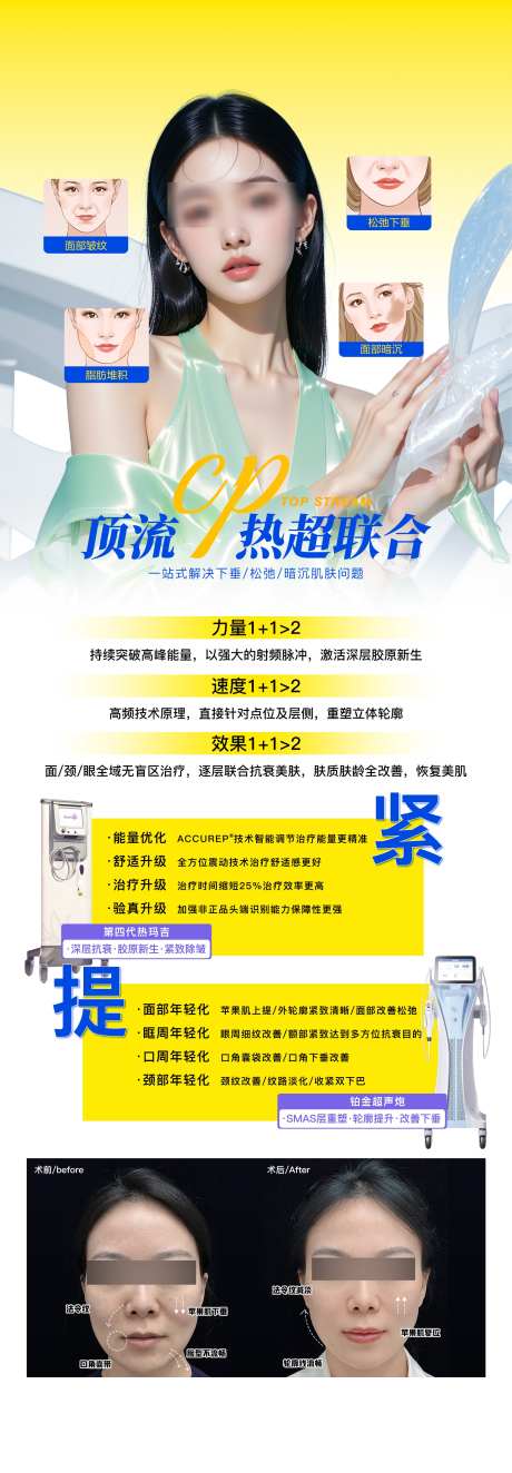 顶流CP热超联合_源文件下载_PSD格式_2000X5757像素-案例,对比,美容-作品编号:2025071416218498-志′设·网