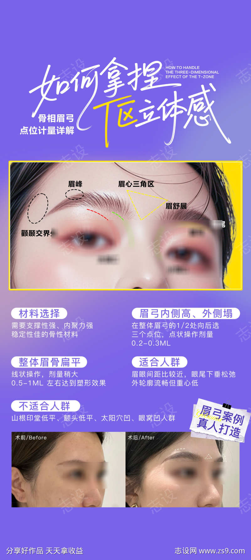 如何拿捏T区立体感