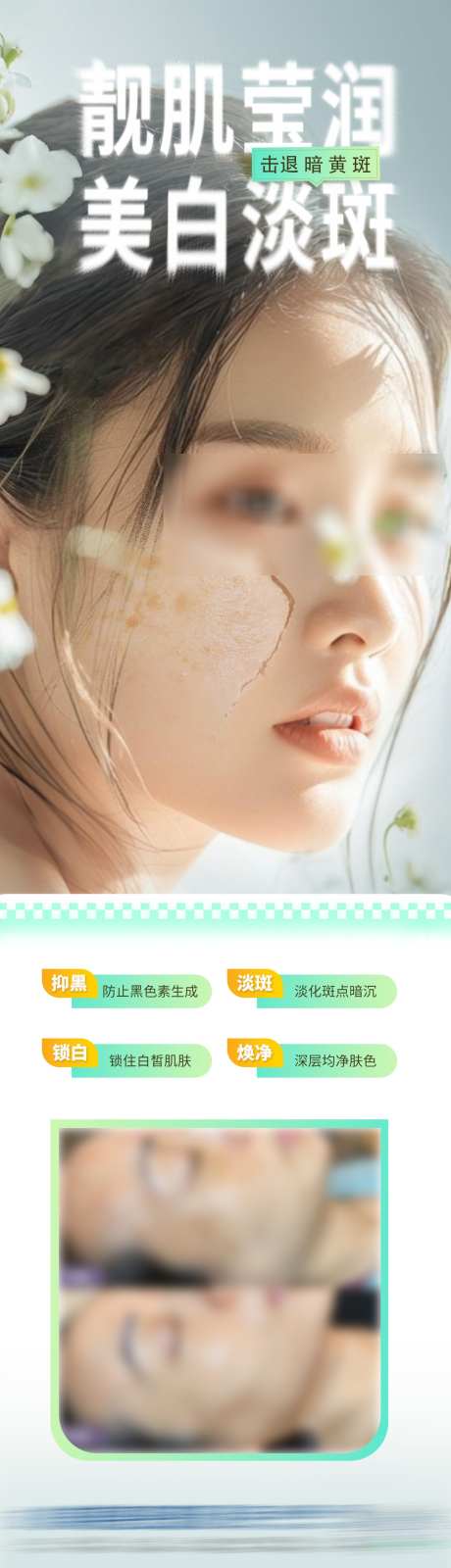 医美美白淡斑美肤案例海报_源文件下载_PSD格式_1284X4543像素-对比,祛斑,皮肤-作品编号:2025071713398724-志ˈ̹设˓网