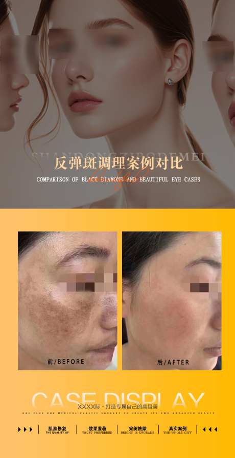 案例对比图_源文件下载_PSD格式_1080X2100像素-案例海报,医美案例,对比图-作品编号:2025071811064284-志设