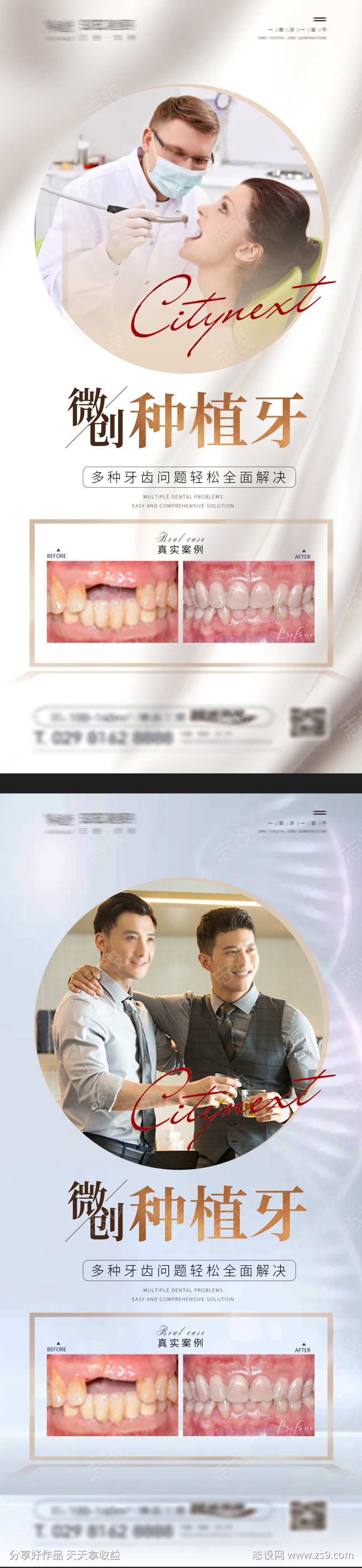 口腔案例对比