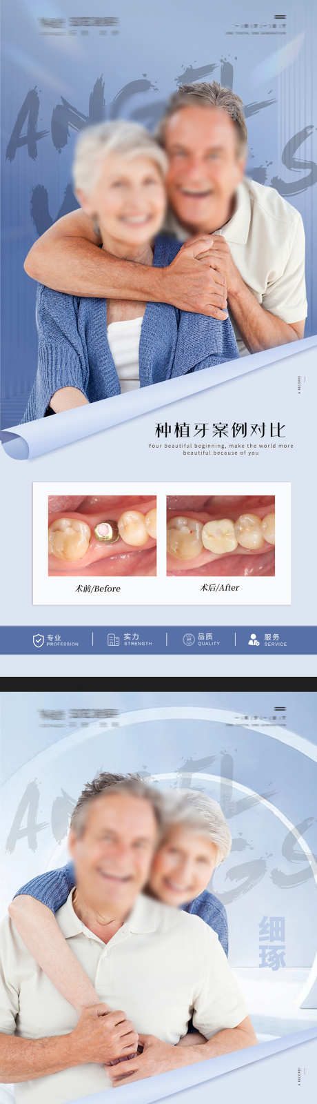 口腔案例对比_源文件下载_PSD格式_1134X4877像素-矫正,医疗,牙齿-作品编号:2025072316466837-志设-zs9.com