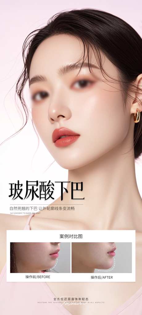 玻尿酸下巴_源文件下载_PSD格式_1080X2400像素-假体,玻尿酸,海报-作品编号:2025071816145327-志设-zs9.com