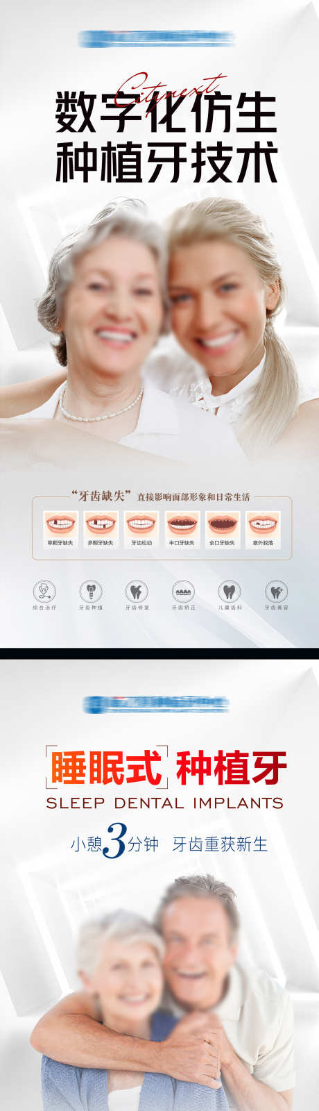 数字化种植牙_源文件下载_PSD格式_2835X11714像素-缺牙,技术,种植牙-作品编号:2025072609228975-志设-zs9.com