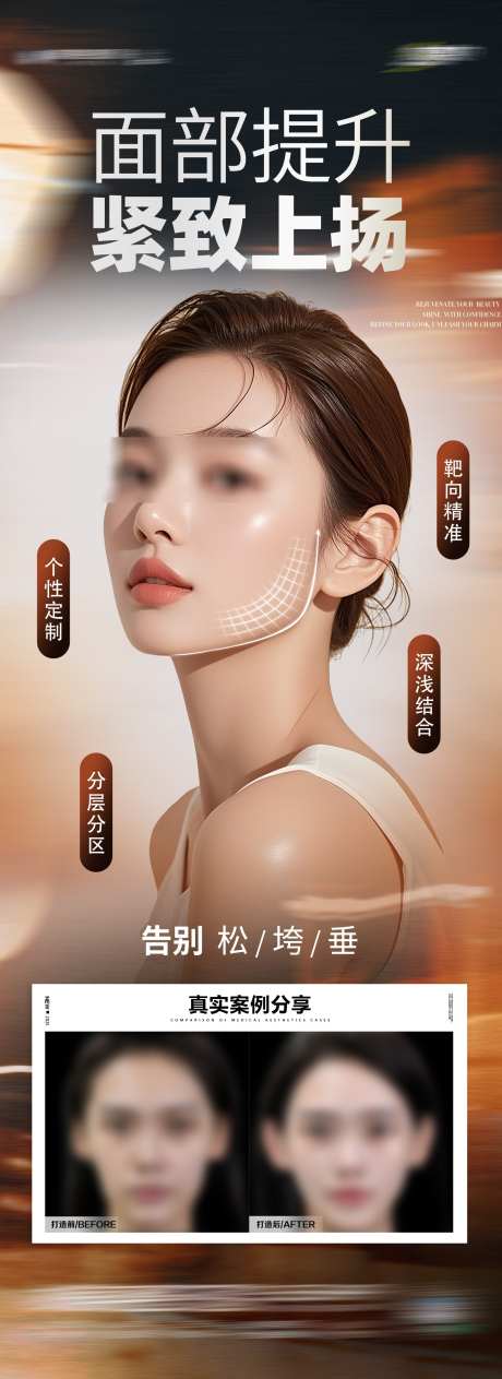 医美面部提升抗衰年轻化案例创意海报_源文件下载_PSD格式_1563X4293像素-幼态脸,年轻化,抗衰-作品编号:2025072109461596-志设-zs9.com