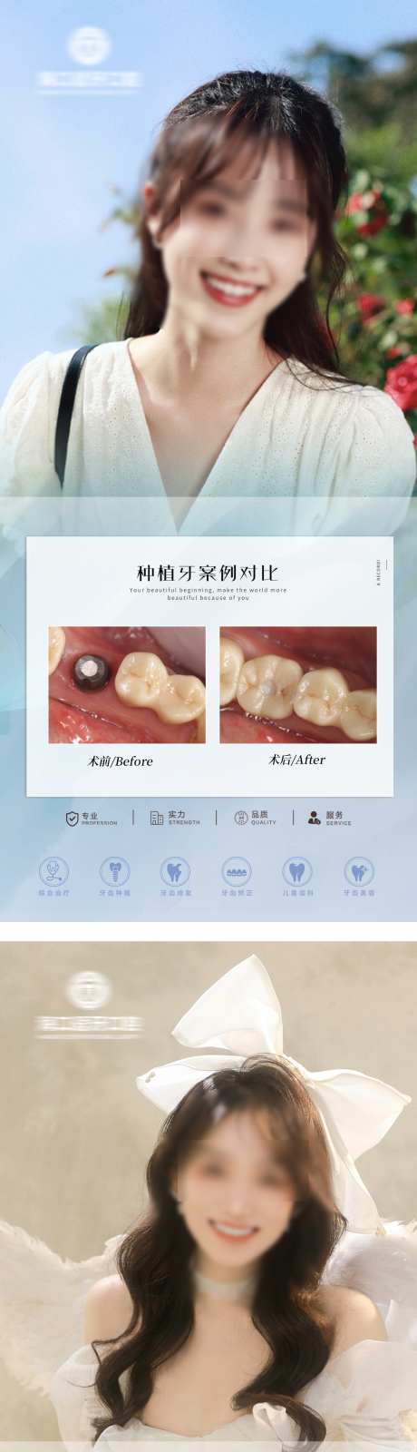 口腔案例前后_源文件下载_PSD格式_1563X6984像素-正畸,种植牙,前后-作品编号:2025072516258863-志设-zs9.com