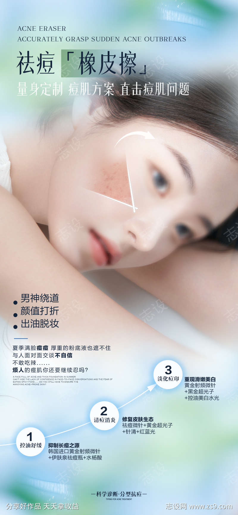 医美祛痘海报