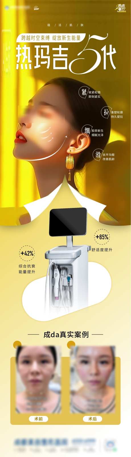 热玛吉海报_源文件下载_CDR格式_1182X4171像素-紧致,宣传,活动-作品编号:2025072716028264-志,设ˆ网
