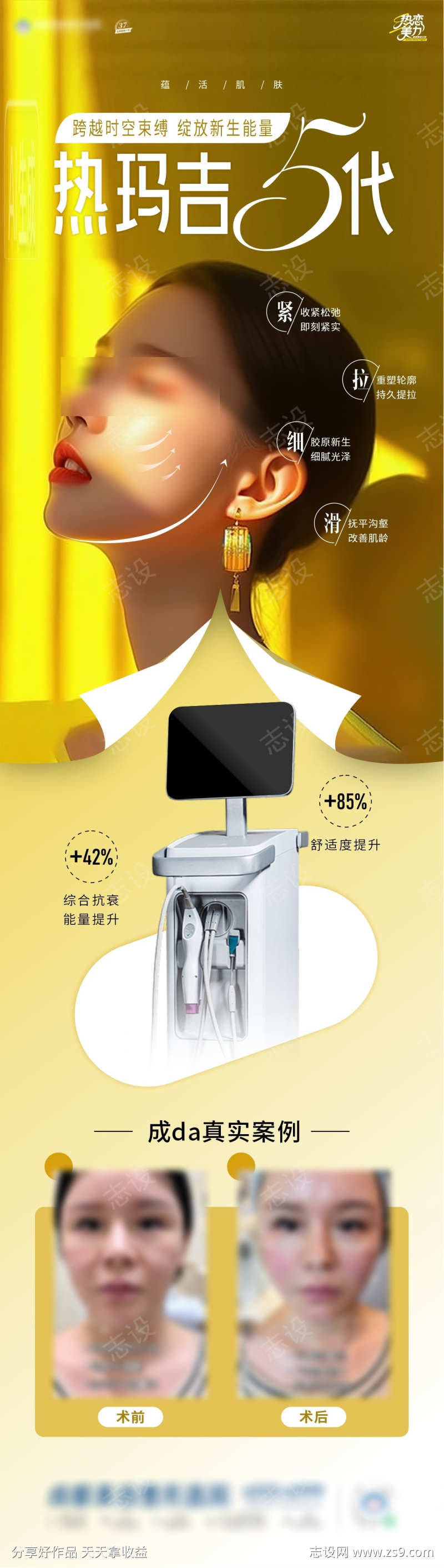 热玛吉海报