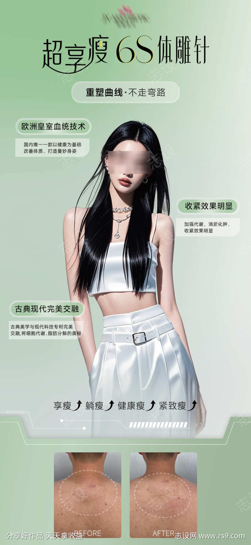 超享瘦6s体雕针