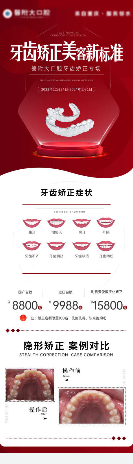 口腔详情页_源文件下载_PSD格式_1500X5398像素-种植牙,矫正,详情页-作品编号:2025080514163171-源文件库-ywjfx.cn
