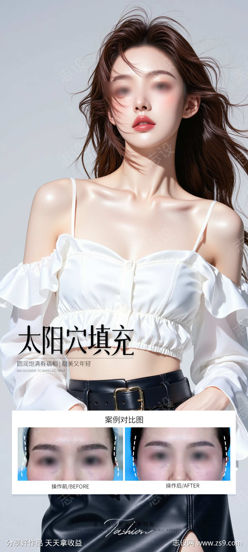 太阳穴填充案例海报