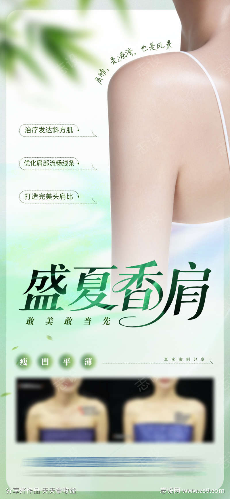 医美直角肩肩膀整形案例创意海报
