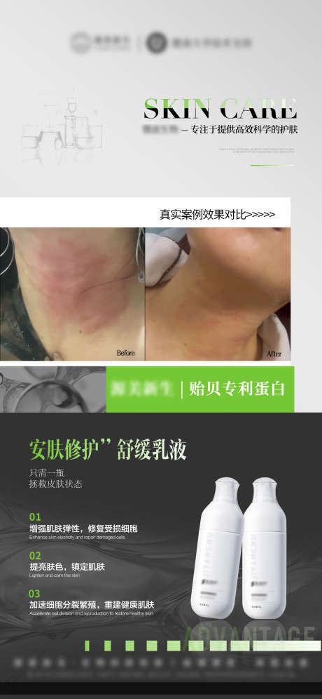 美业产品敏感肌修护精华海报_源文件下载_PSD格式_1540X3333像素-精华,修护,敏感肌-作品编号:2025081217031801-志设-zs9.com