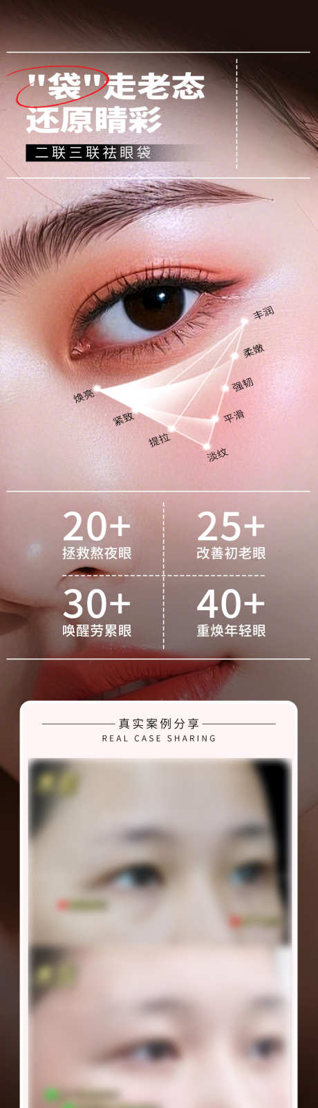 医美二联三联祛眼袋年轻化案例创意海报_源文件下载_PSD格式_1284X4984像素-提拉,紧致,淡纹-作品编号:2025081417252448-志˯设˓网