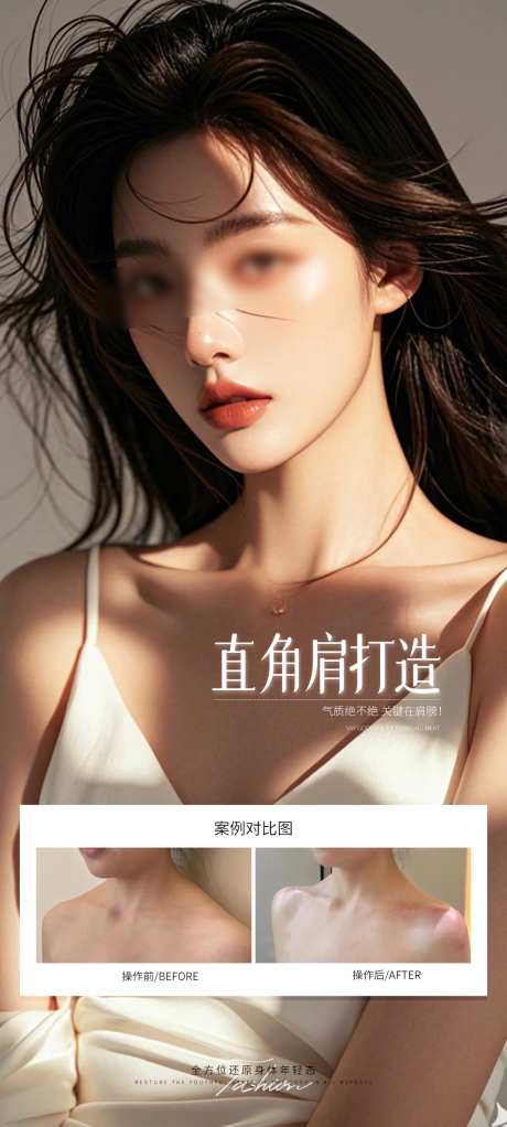 直角肩打造案例海报_源文件下载_PSD格式_1080X2400像素-海报,医美,肩颈-作品编号:2025082111225803-志设