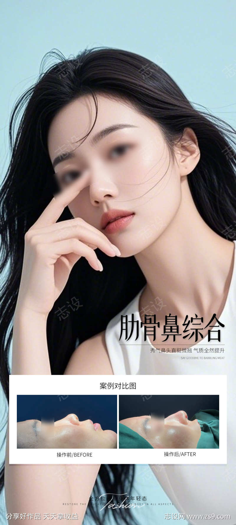 肋骨鼻综合案例海报