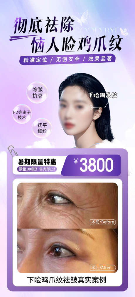 医美案例活动海报_源文件下载_PSD格式_1125X2467像素-活动海报,案例海报,活动海报-作品编号:2025082408553159-志͵设`网