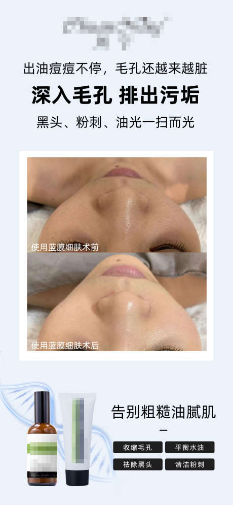 护肤品对比图海报_源文件下载_PSD格式_1386X2998像素-皮肤管理,简约,产品-作品编号:2025083013486483-志设