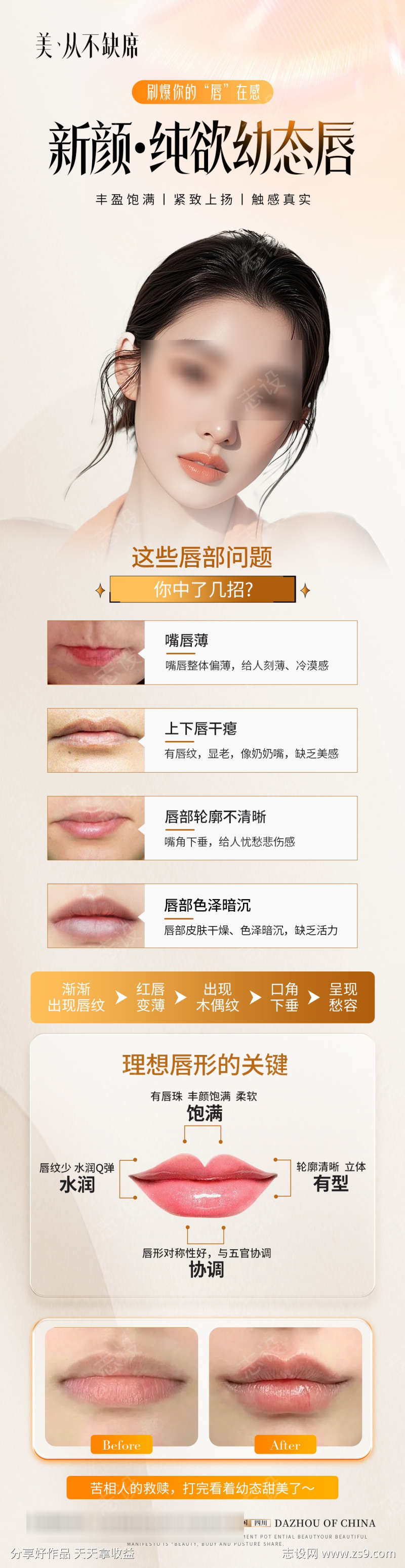 医美丰唇案例科普长图