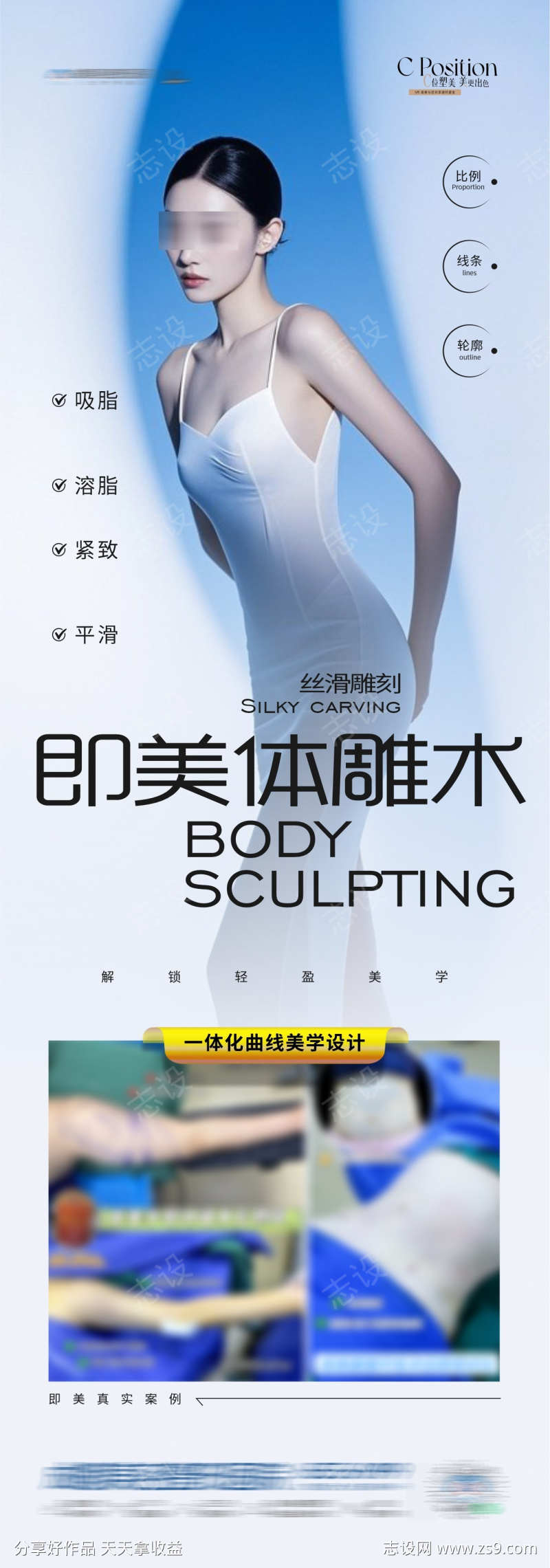 医美体雕术吸脂S型案例长图海报