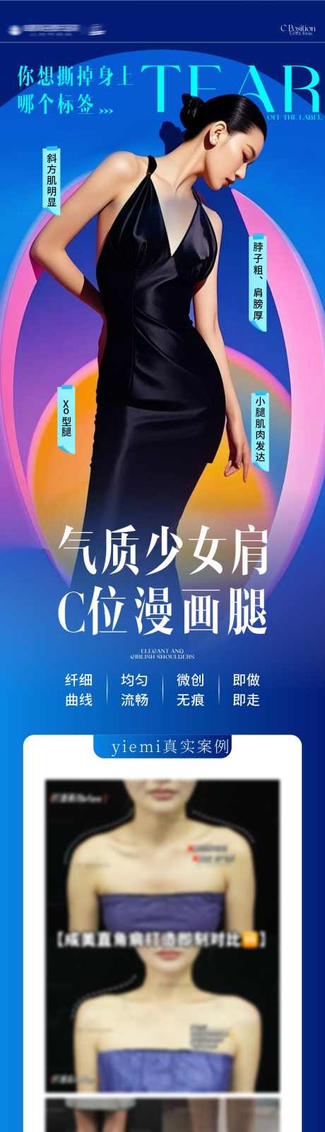 医美体雕海报_源文件下载_CDR格式_1063X4454像素-曲线,减脂,瘦身-作品编号:2025091209354642-志′设·网