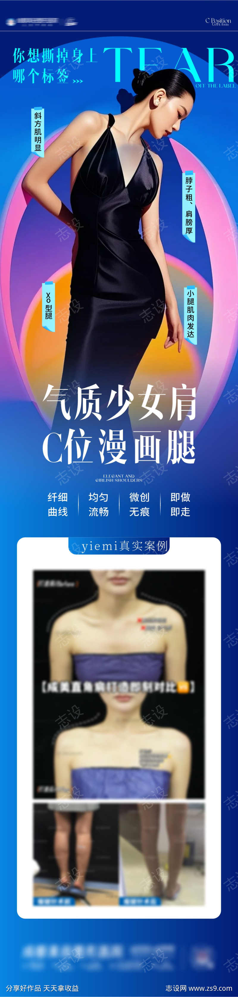 医美体雕海报