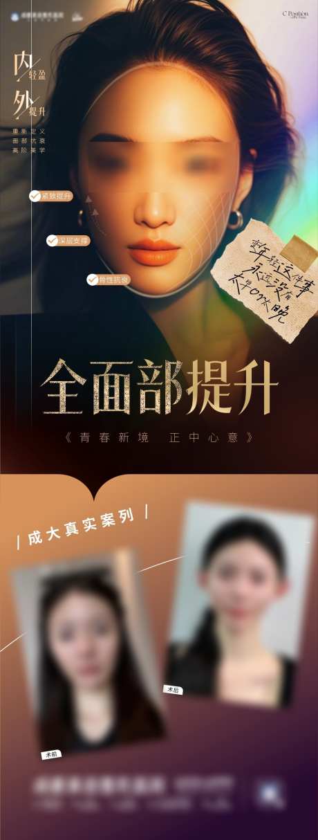 全面部提升海报_源文件下载_CDR格式_973X2567像素-轮廓提升,抗衰,提升-作品编号:2025091209375051-志˙设˯网
