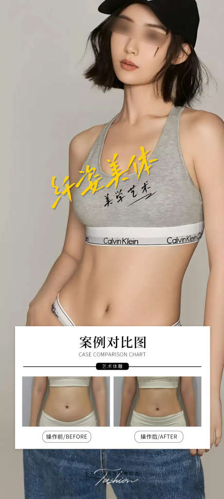 纤姿美体案例海报