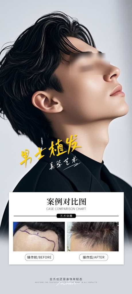 男士植发案例海报