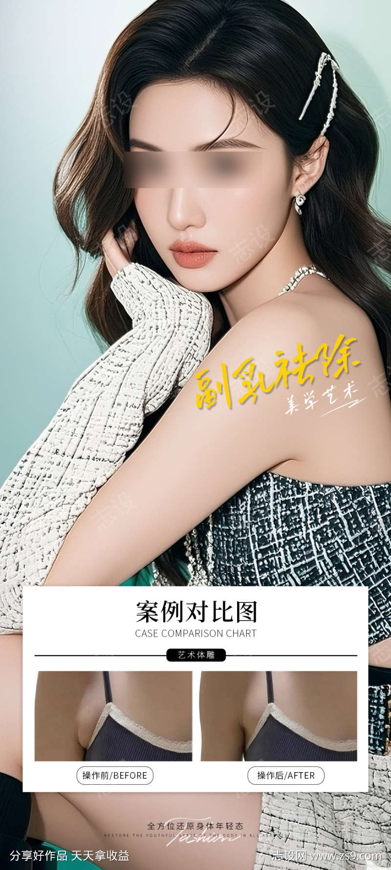 副乳祛除案例海报