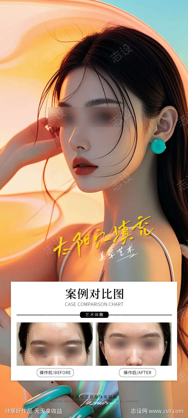 太阳穴案例海报