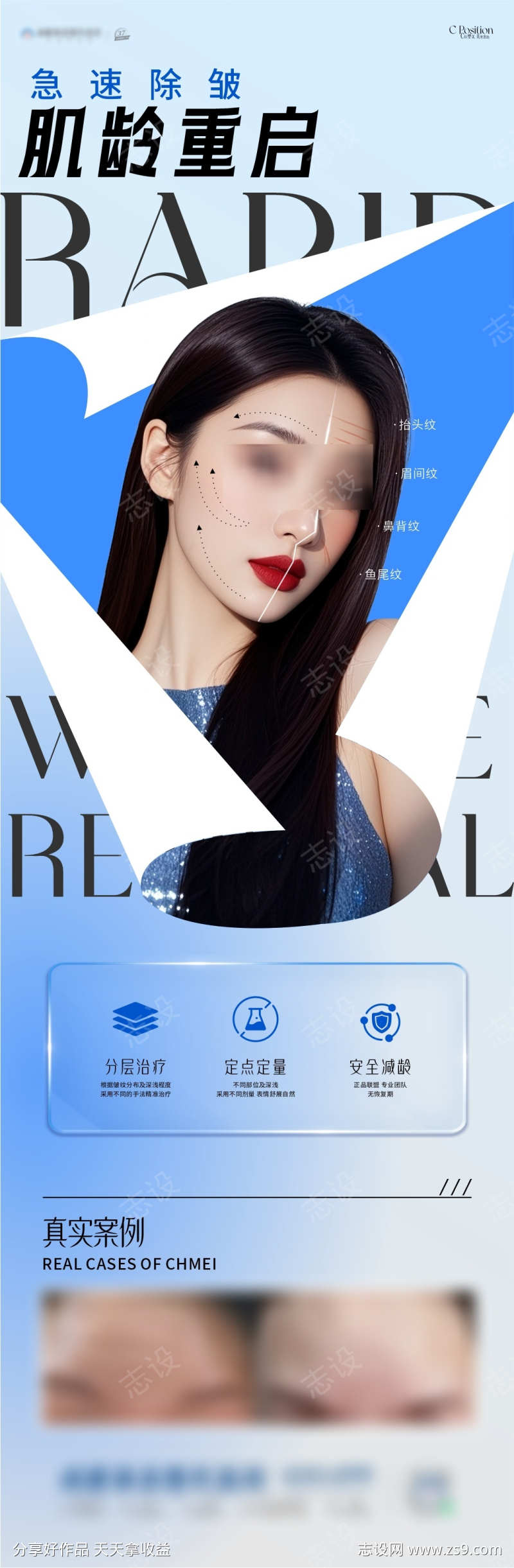 医美除皱海报