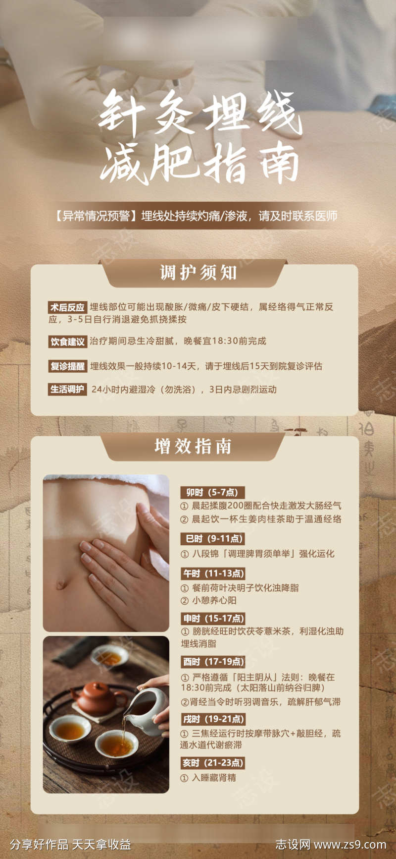 针灸埋线减肥术后注意事项海报
