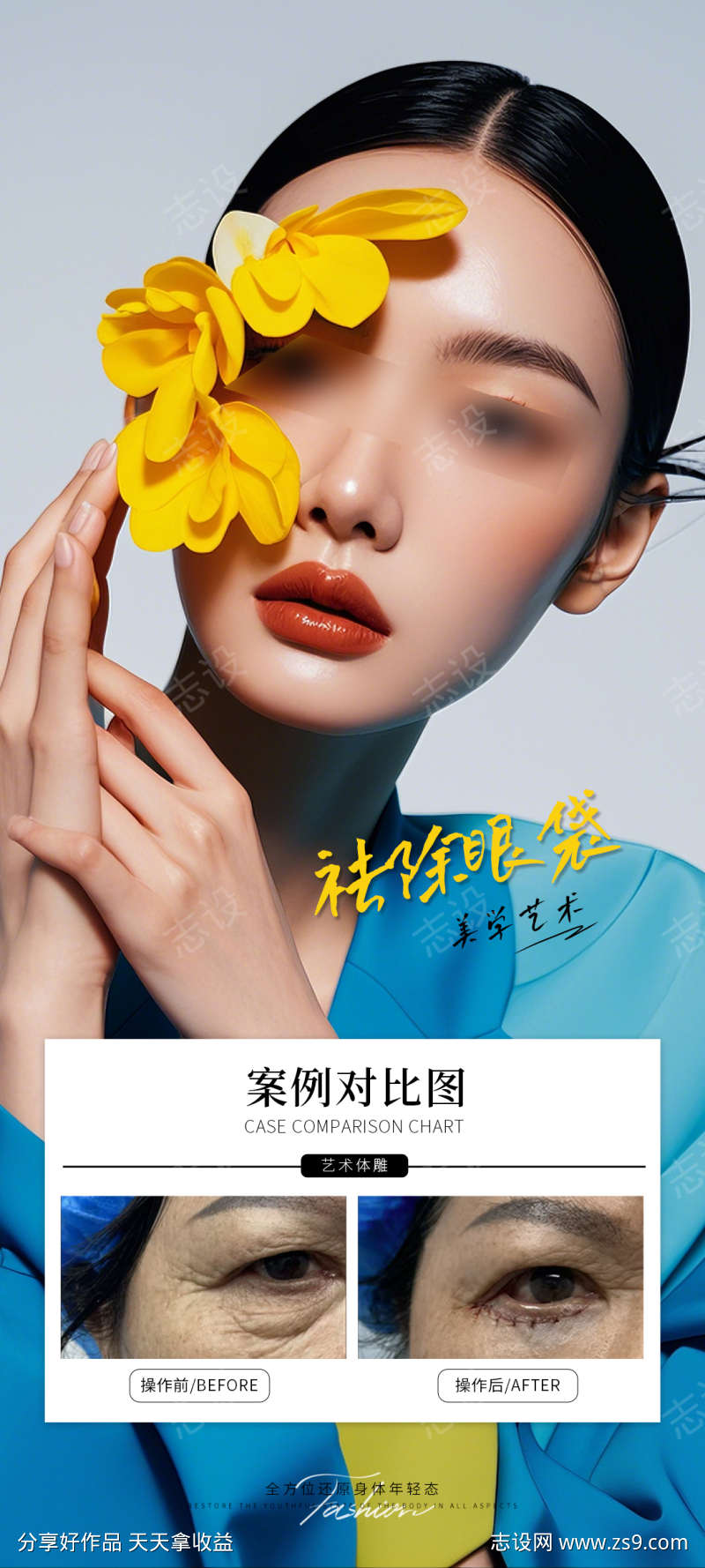 祛除眼袋案例海报