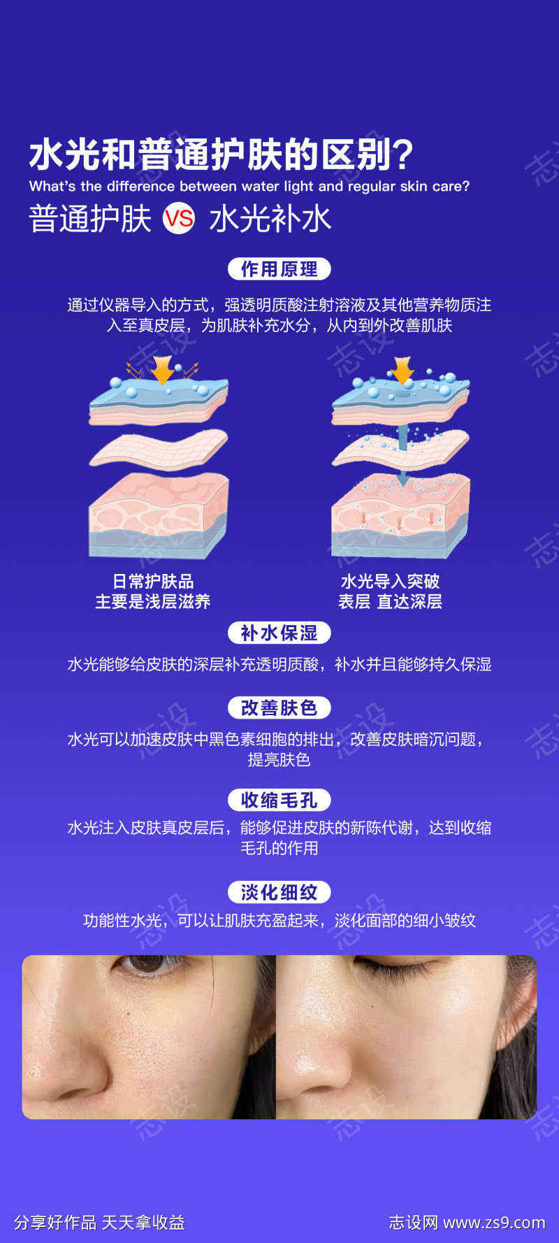 水光和日常护理的区别