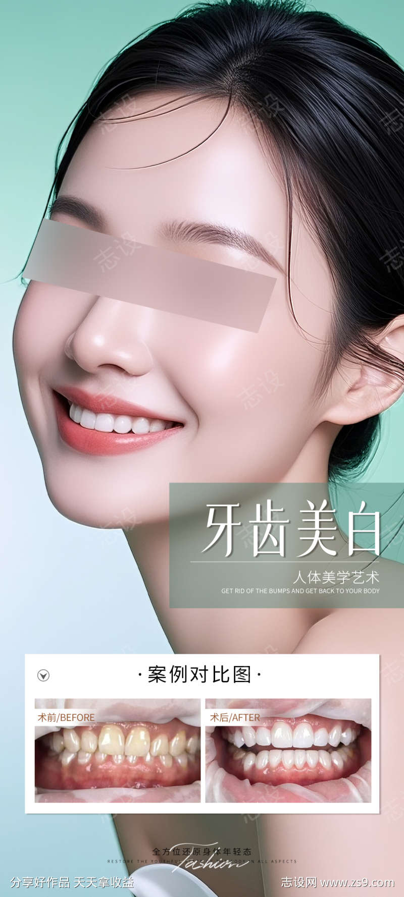 牙齿美白案例海报