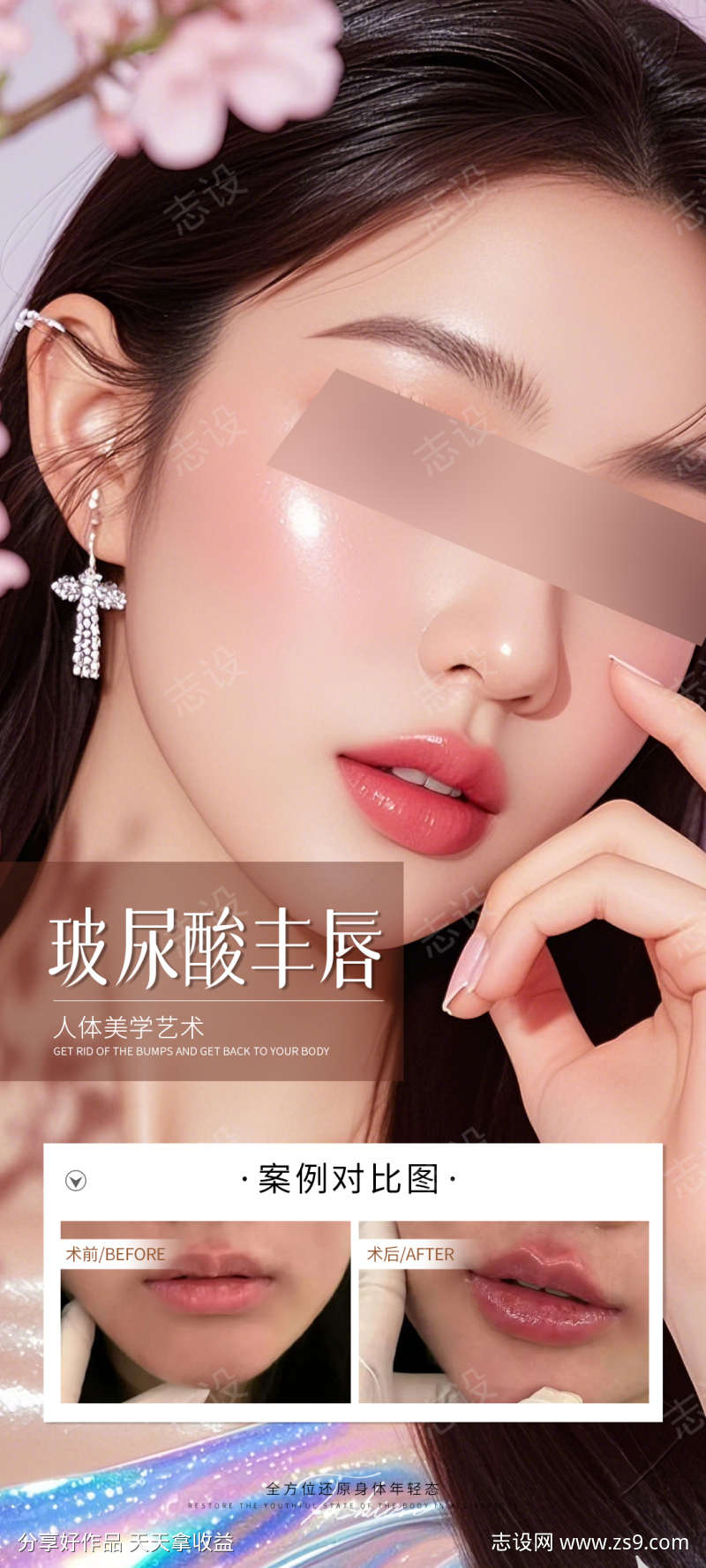 玻尿酸丰唇案例海报